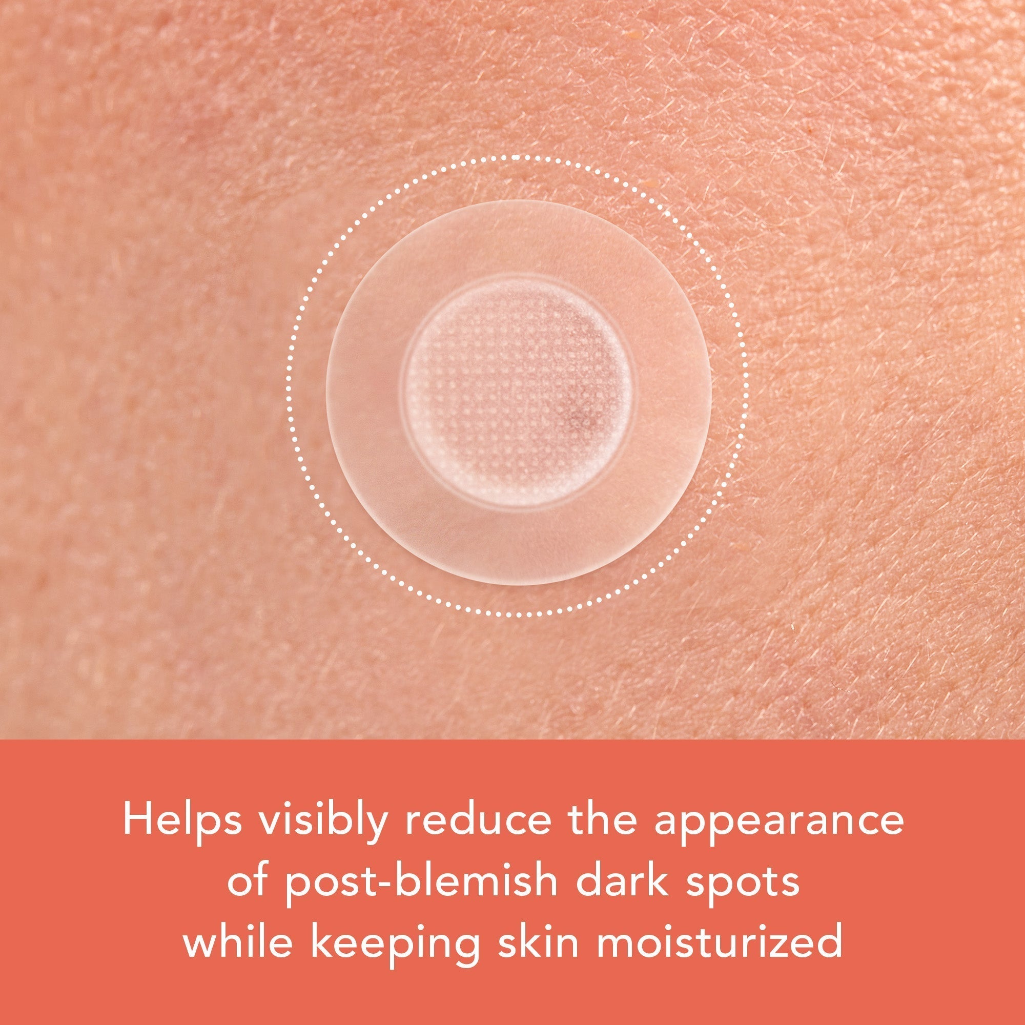 Miracle Patch Microcrystal Vitamin C Dark Spot Cover Z3