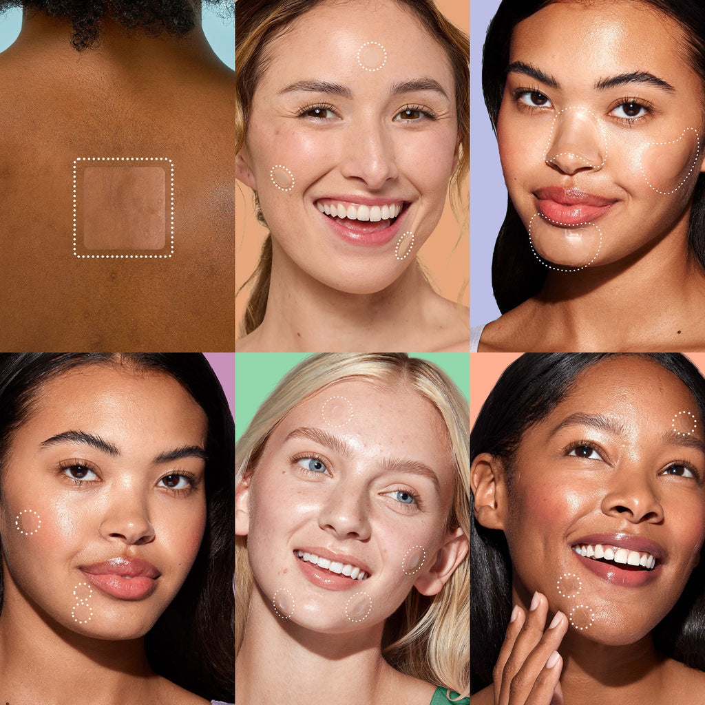 Miracle Patch Ultimate Blemish Patch Kit J2