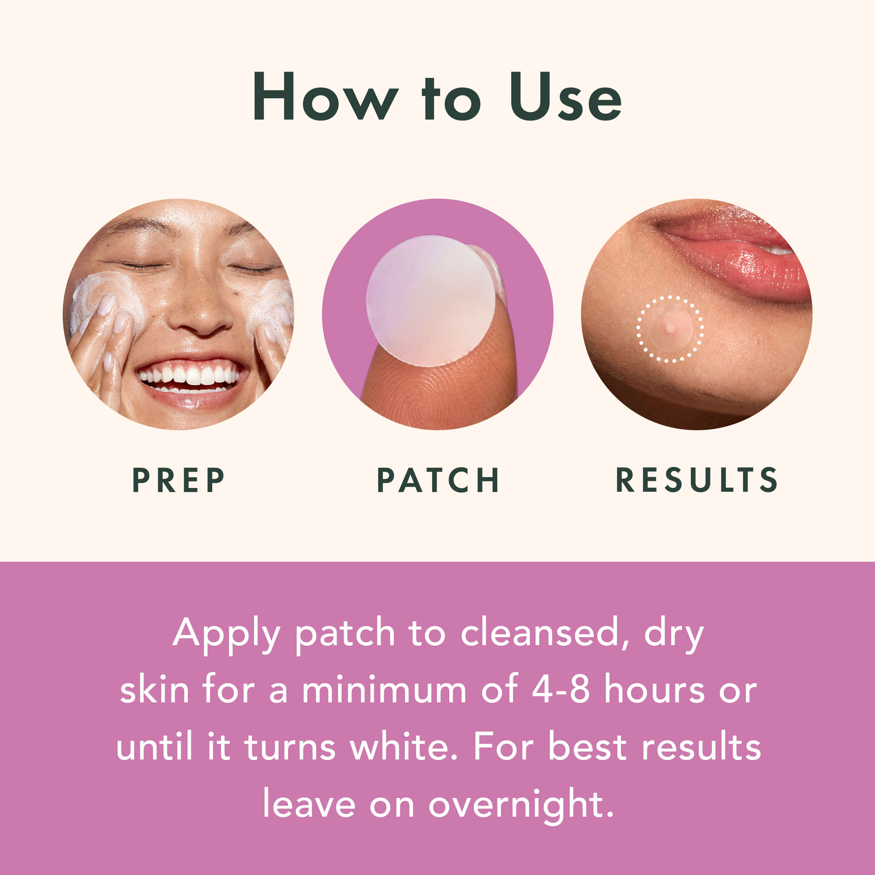 Miracle Patch Overnight Spot Cover A6